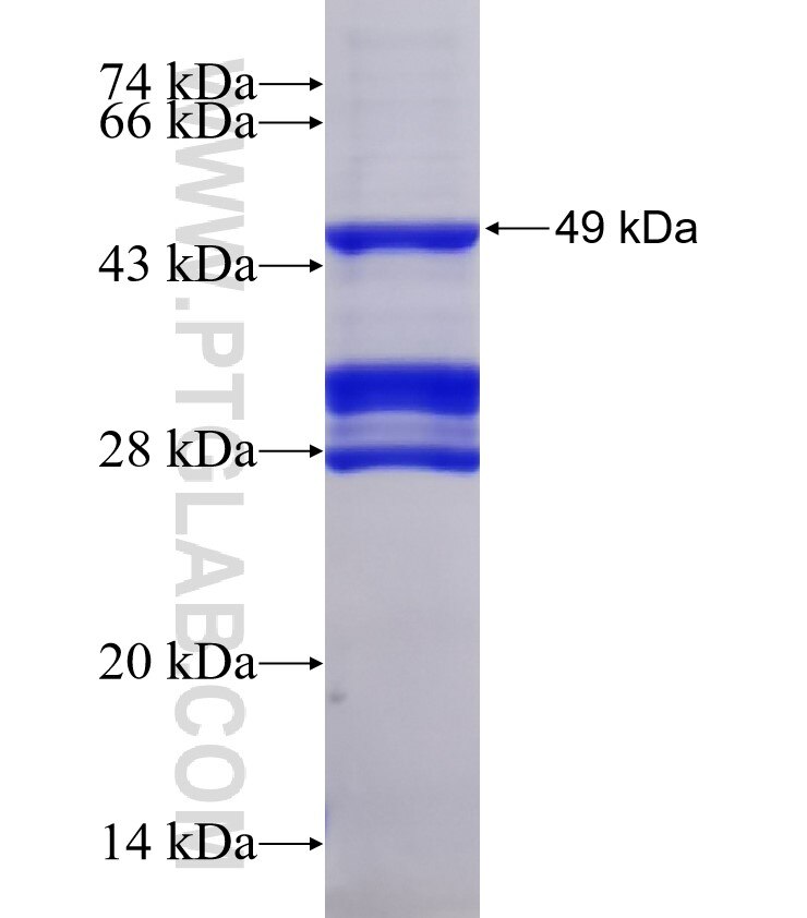 SLC6A11 fusion protein Ag4927 SDS-PAGE