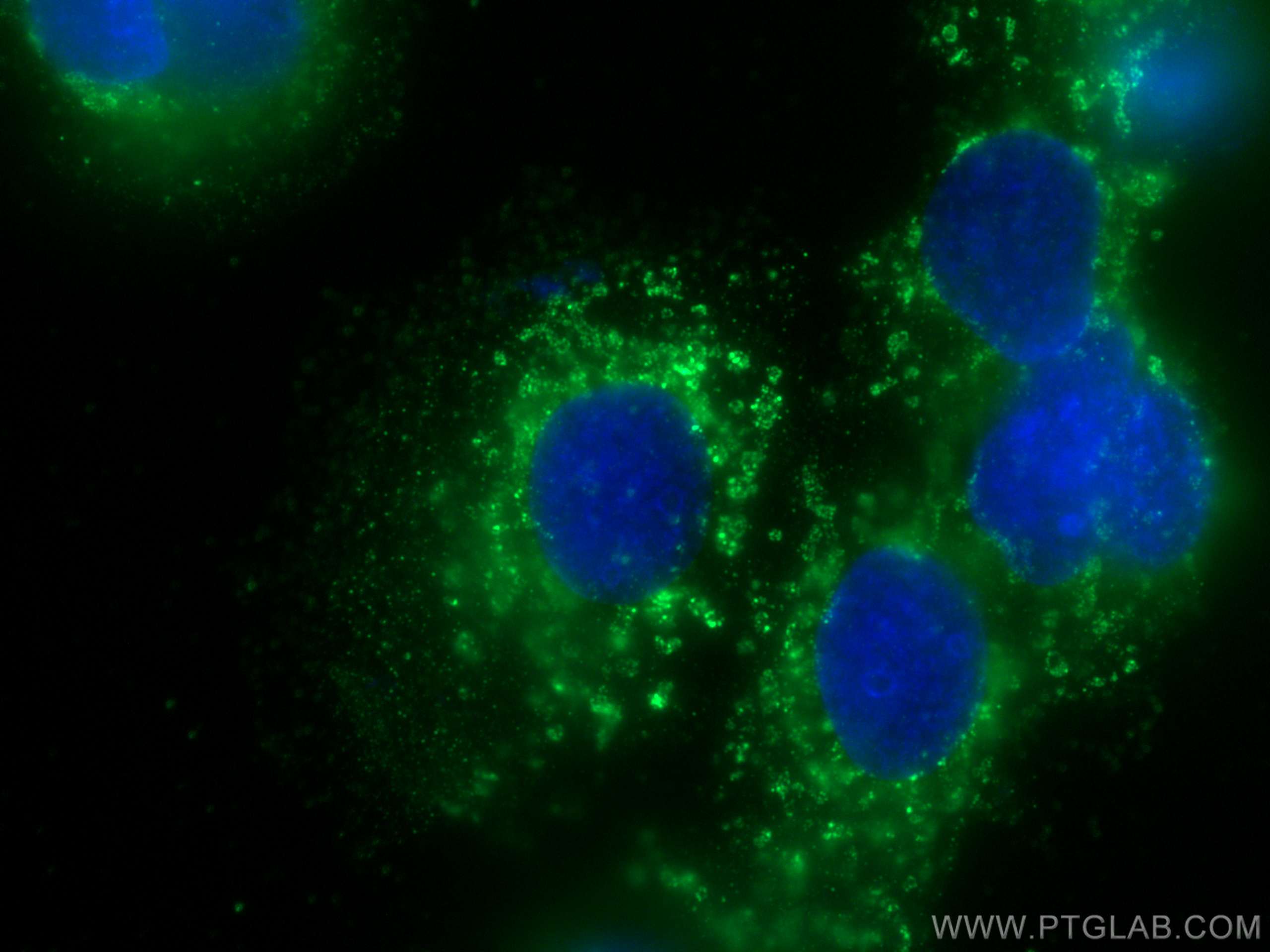 Immunofluorescence (IF) / fluorescent staining of Caco-2 cells using SLC6A12 Monoclonal antibody (67700-1-Ig)