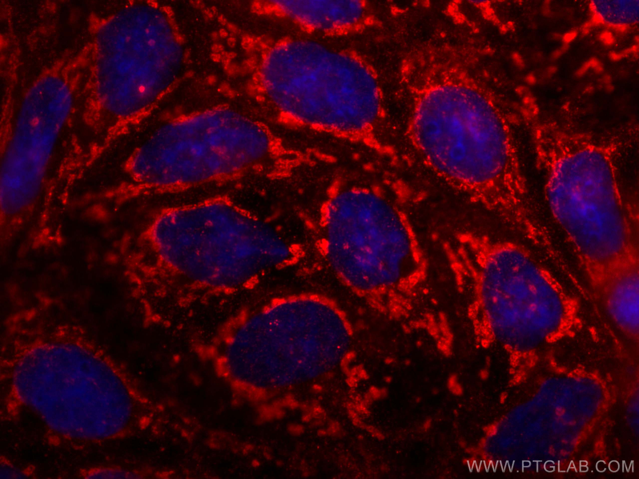 Immunofluorescence (IF) / fluorescent staining of Caco-2 cells using SLC6A12 Monoclonal antibody (67700-1-Ig)
