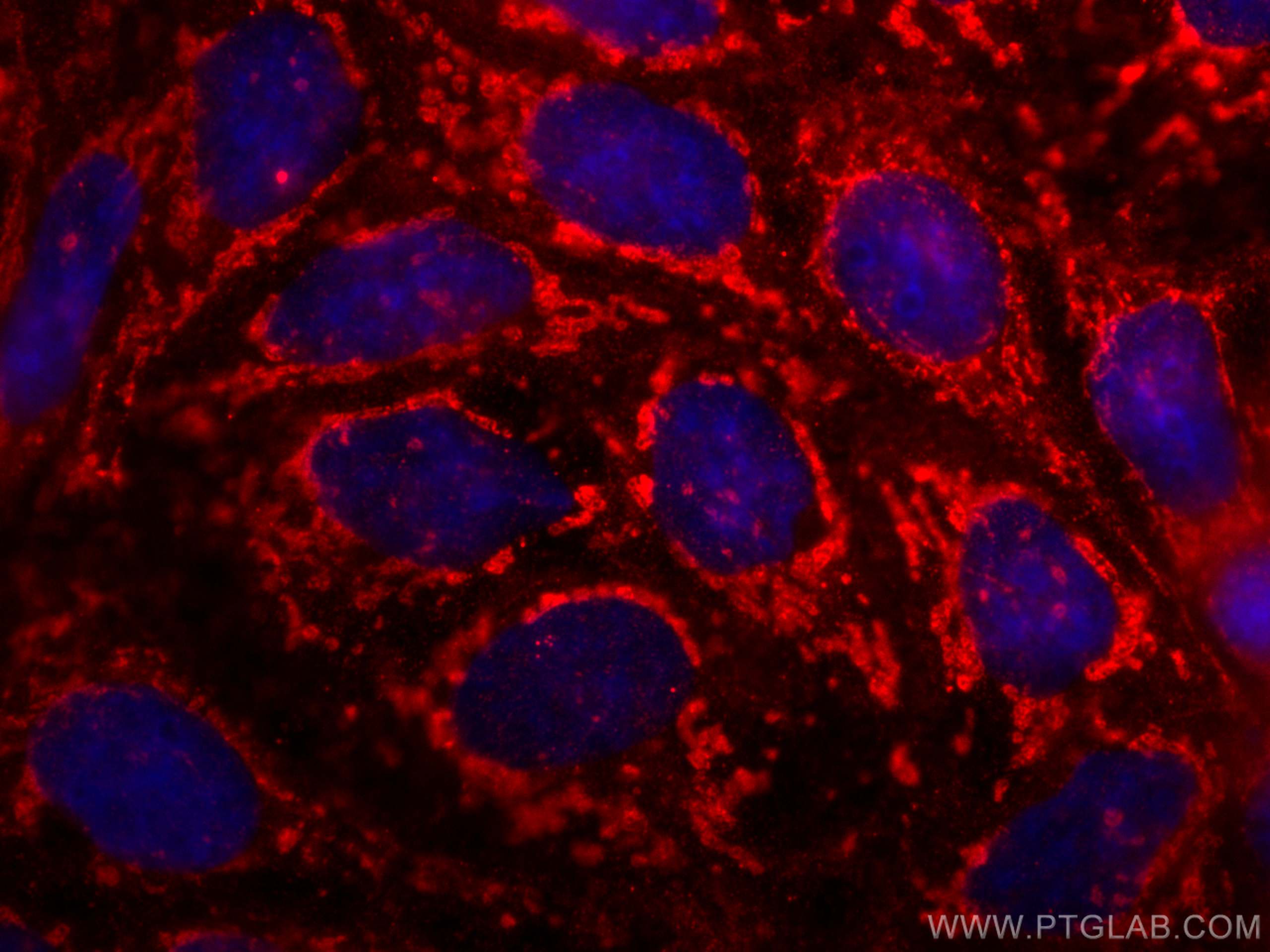 IF Staining of Caco-2 using 67700-1-Ig