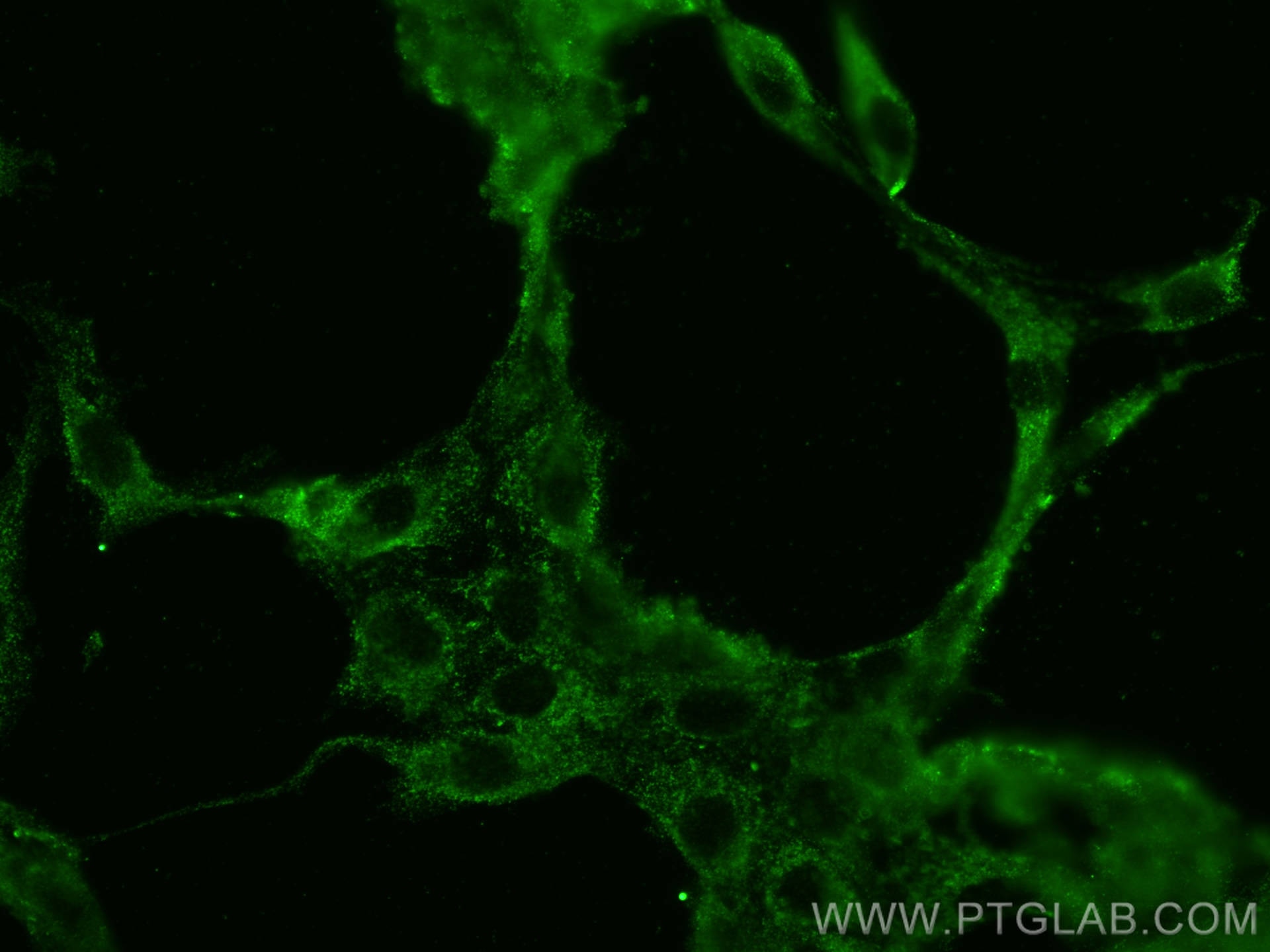 Immunofluorescence (IF) / fluorescent staining of H9C2 cells using SLC6A12 Monoclonal antibody (67700-1-Ig)