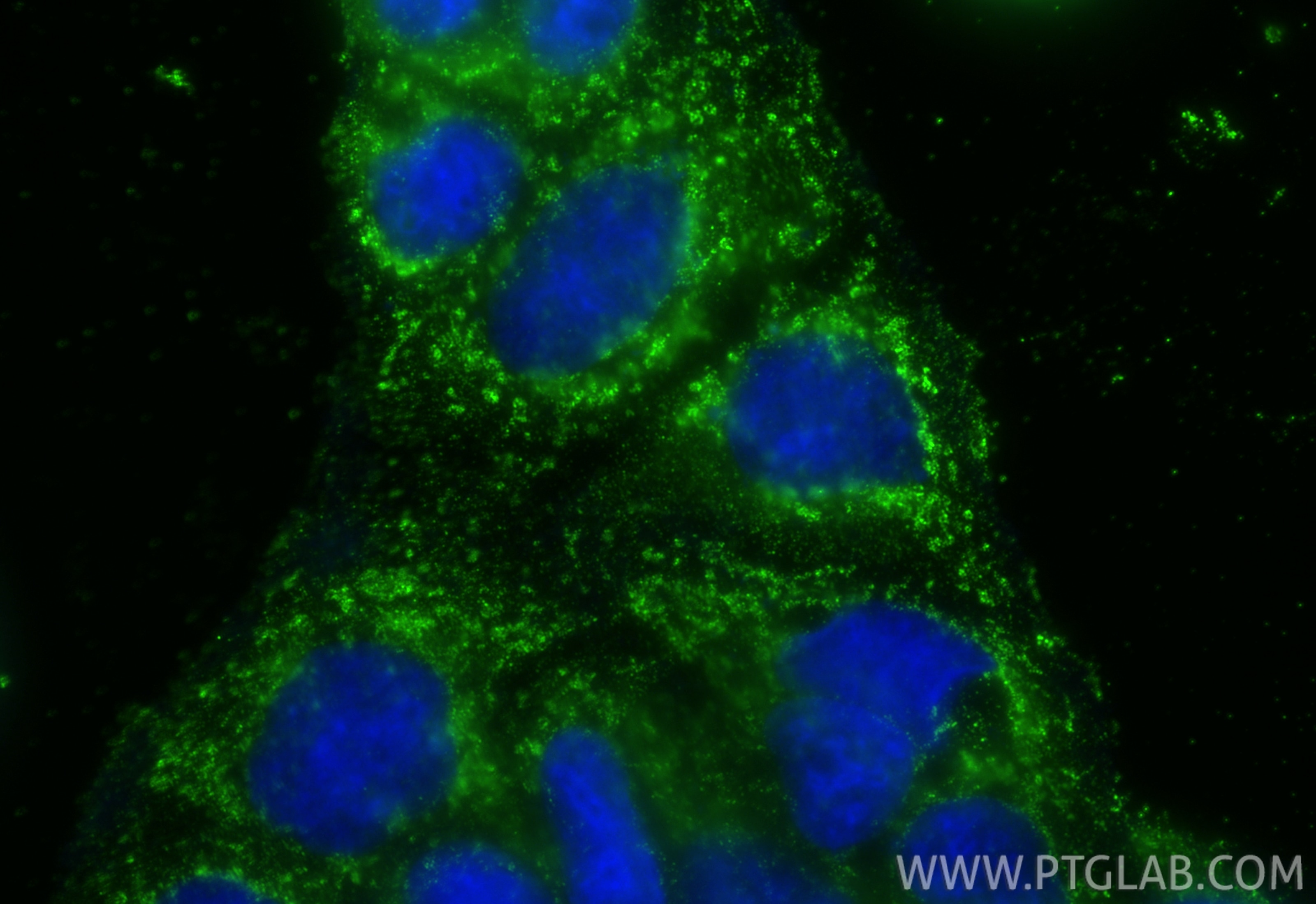Immunofluorescence (IF) / fluorescent staining of Caco-2 cells using SLC6A12 Monoclonal antibody (67700-1-Ig)
