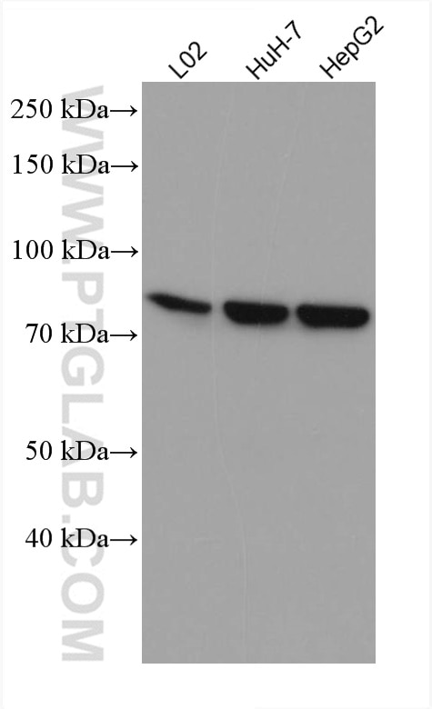 Western Blot (WB) analysis of various lysates using SLC6A12 Monoclonal antibody (67700-1-Ig)