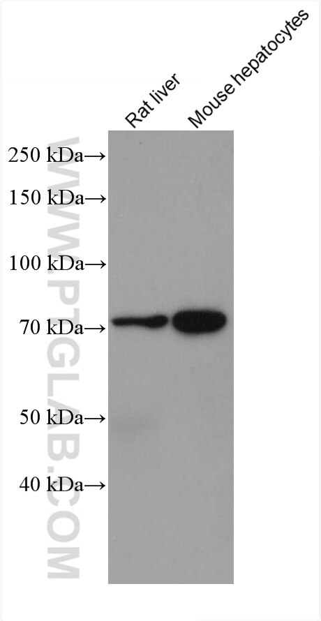 Western Blot (WB) analysis of various lysates using SLC6A12 Monoclonal antibody (67700-1-Ig)
