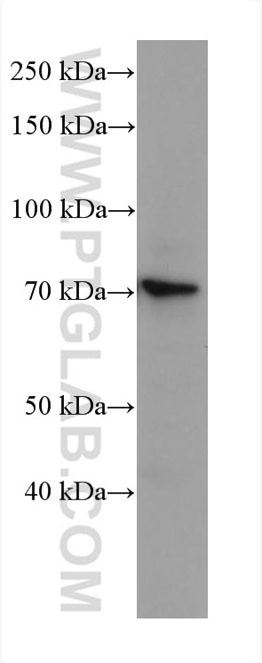 Western Blot (WB) analysis of HSC-T6 cells using SLC6A12 Monoclonal antibody (67700-1-Ig)
