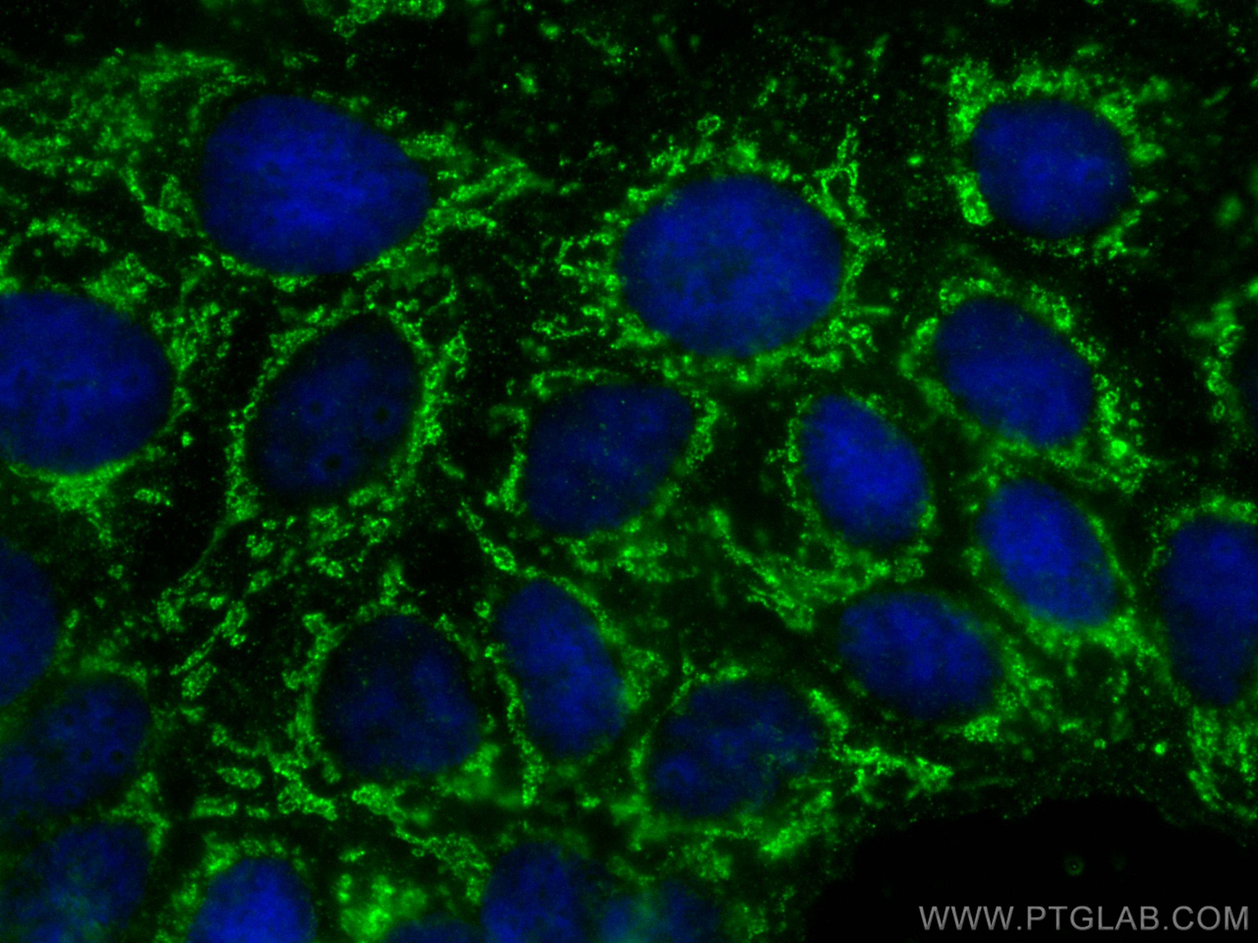 Immunofluorescence (IF) / fluorescent staining of Caco-2 cells using CoraLite® Plus 488-conjugated SLC6A12 Monoclonal a (CL488-67700)