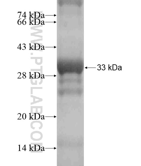 SLC6A12 fusion protein Ag18778 SDS-PAGE