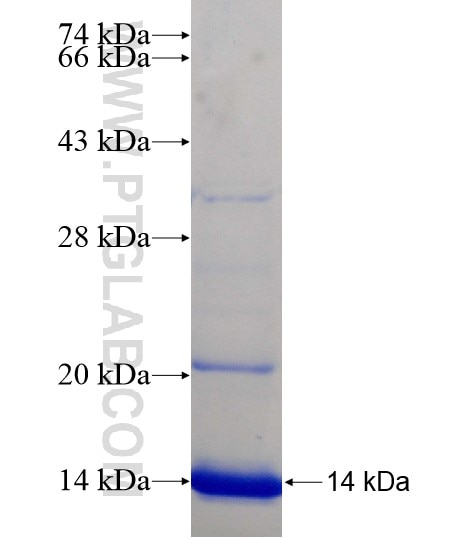 SLC6A12 fusion protein Ag18962 SDS-PAGE