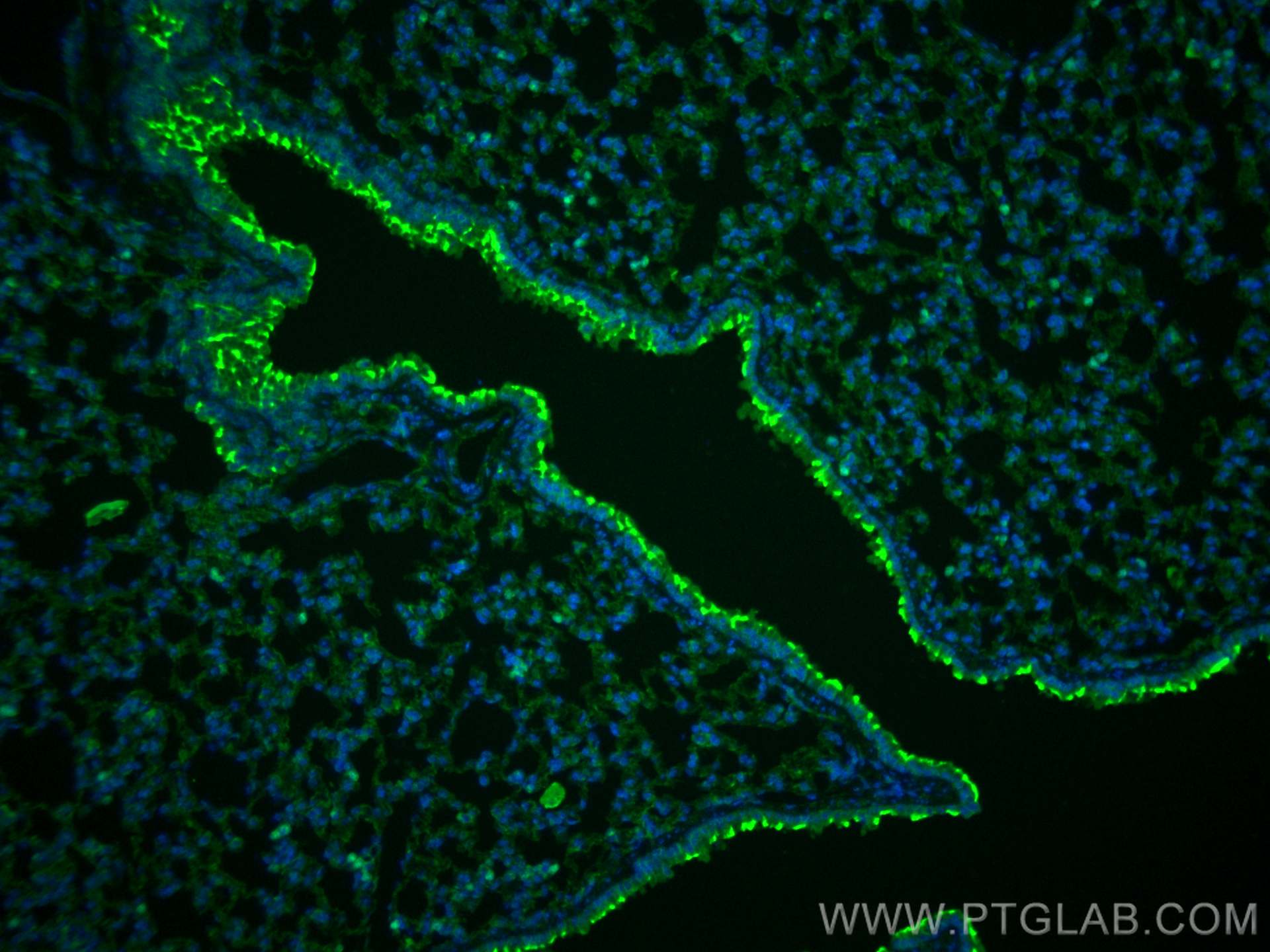 Immunofluorescence (IF) / fluorescent staining of mouse lung tissue using SLC6A14 Polyclonal antibody (18388-1-AP)