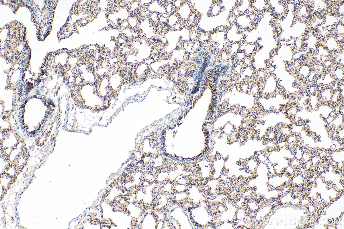 IHC staining of mouse lung using 18388-1-AP