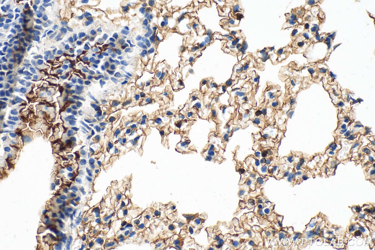 Immunohistochemistry (IHC) staining of mouse lung tissue using SLC6A14 Polyclonal antibody (18388-1-AP)