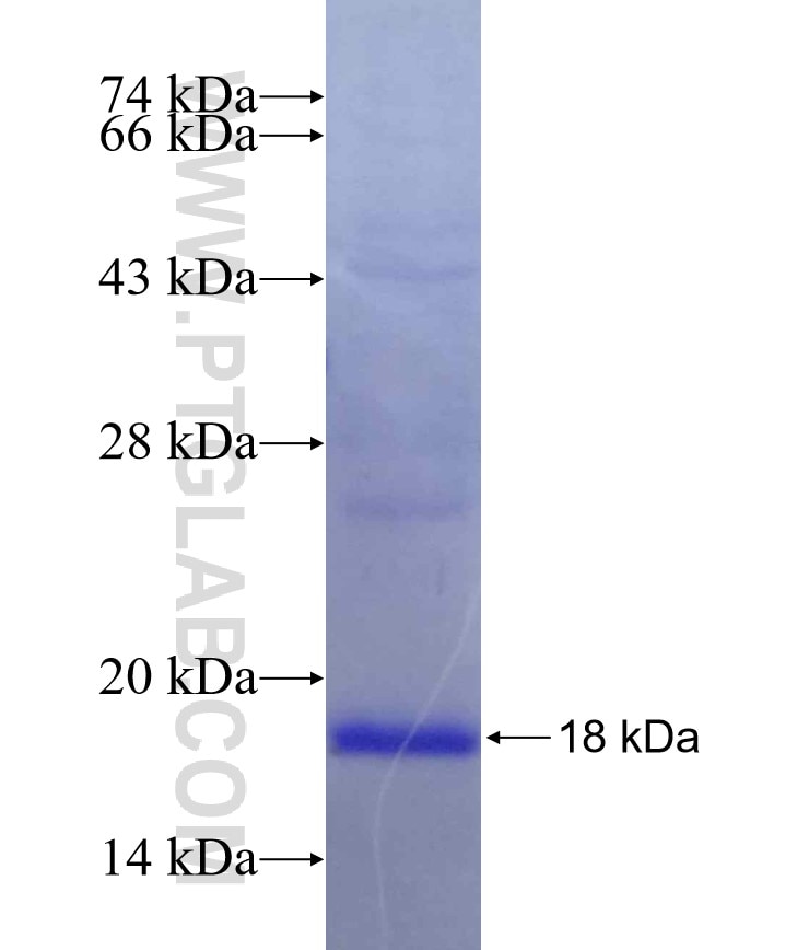 SLC6A14 fusion protein Ag12857 SDS-PAGE