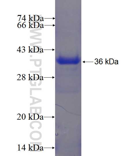 SLC6A15 fusion protein Ag24375 SDS-PAGE