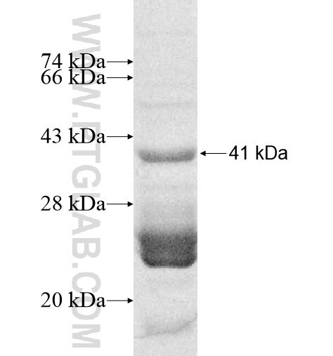 SLC6A16 fusion protein Ag10574 SDS-PAGE