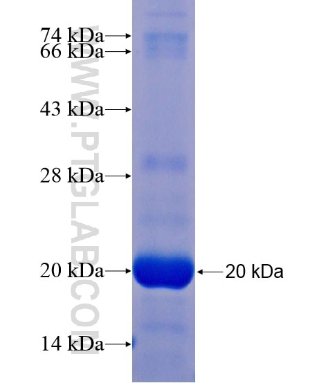SLC6A16 fusion protein Ag21126 SDS-PAGE