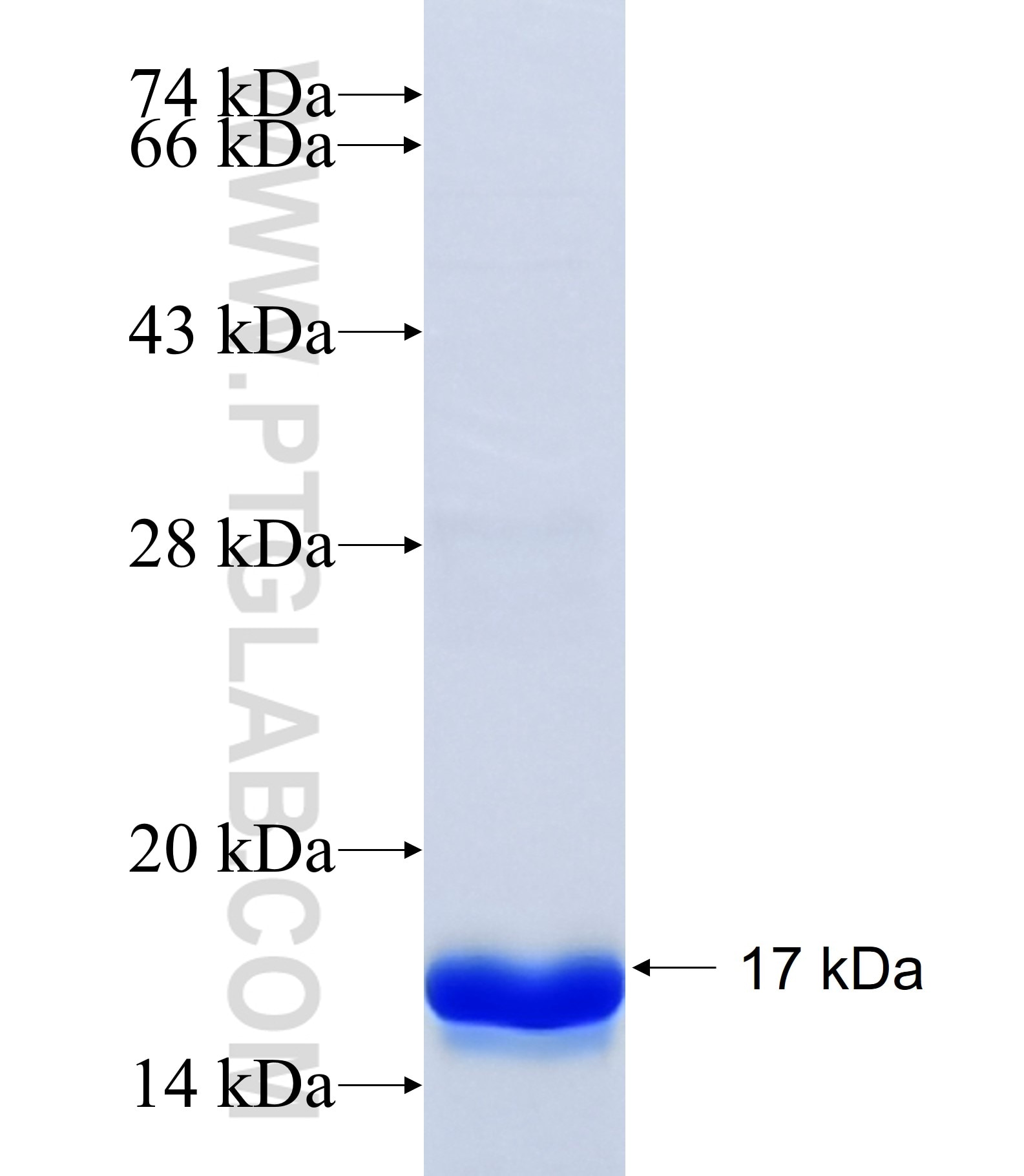 SLC6A17 fusion protein Ag34559 SDS-PAGE SLC6A17 fusion protein Ag34559 SDS-PAGE