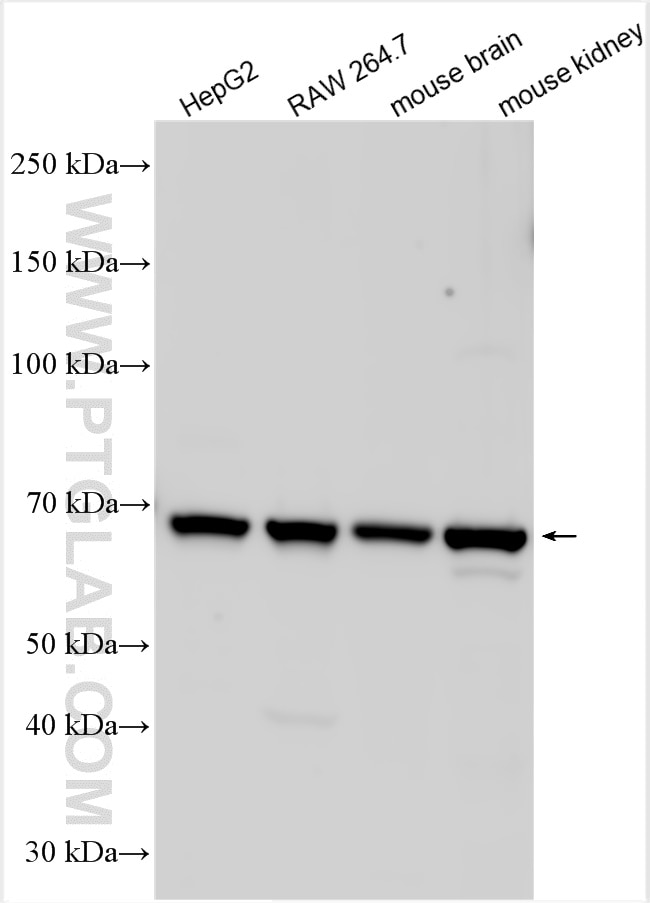 Western Blot (WB) analysis of various lysates using SLC6A18 Polyclonal antibody (17876-1-AP)