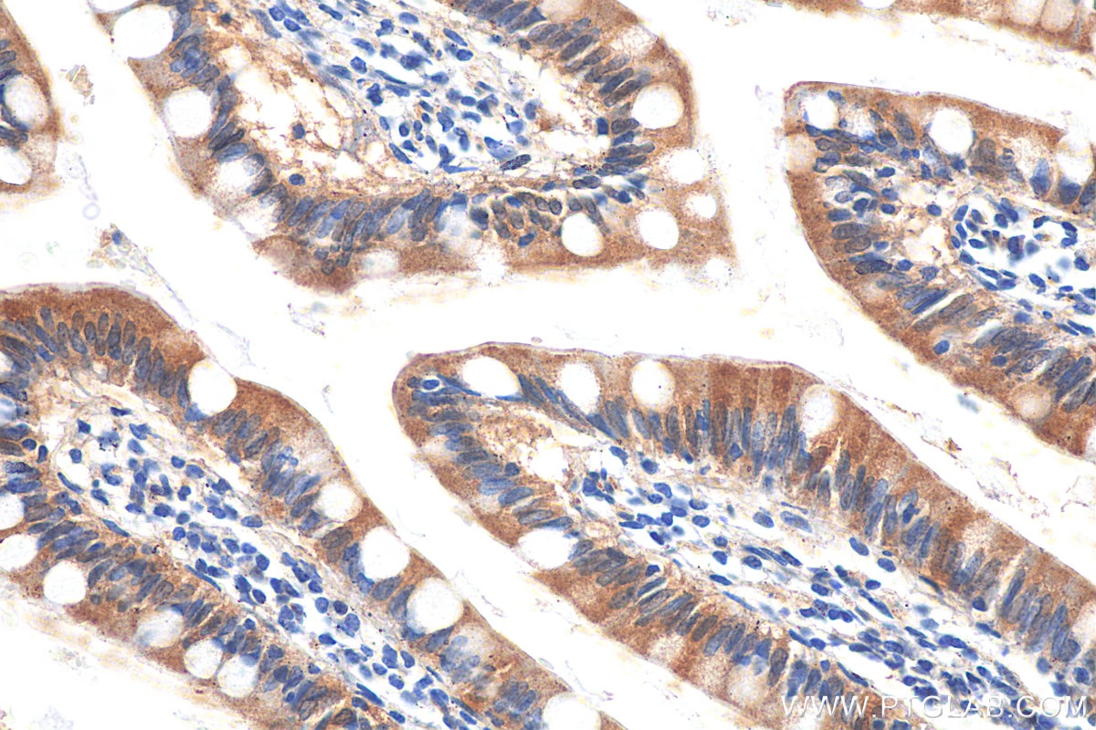 Immunohistochemistry (IHC) staining of human small intestine tissue using SLC6A19 Polyclonal antibody (27575-1-AP)
