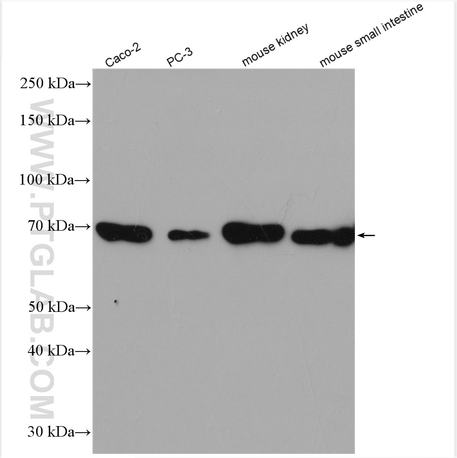 Western Blot (WB) analysis of various lysates using SLC6A19 Polyclonal antibody (27575-1-AP)