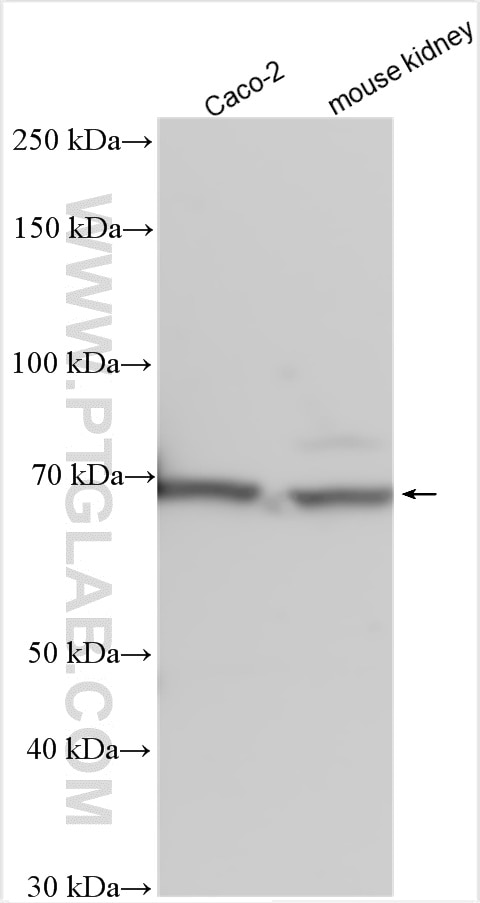 Western Blot (WB) analysis of various lysates using SLC6A19 Polyclonal antibody (27575-1-AP)