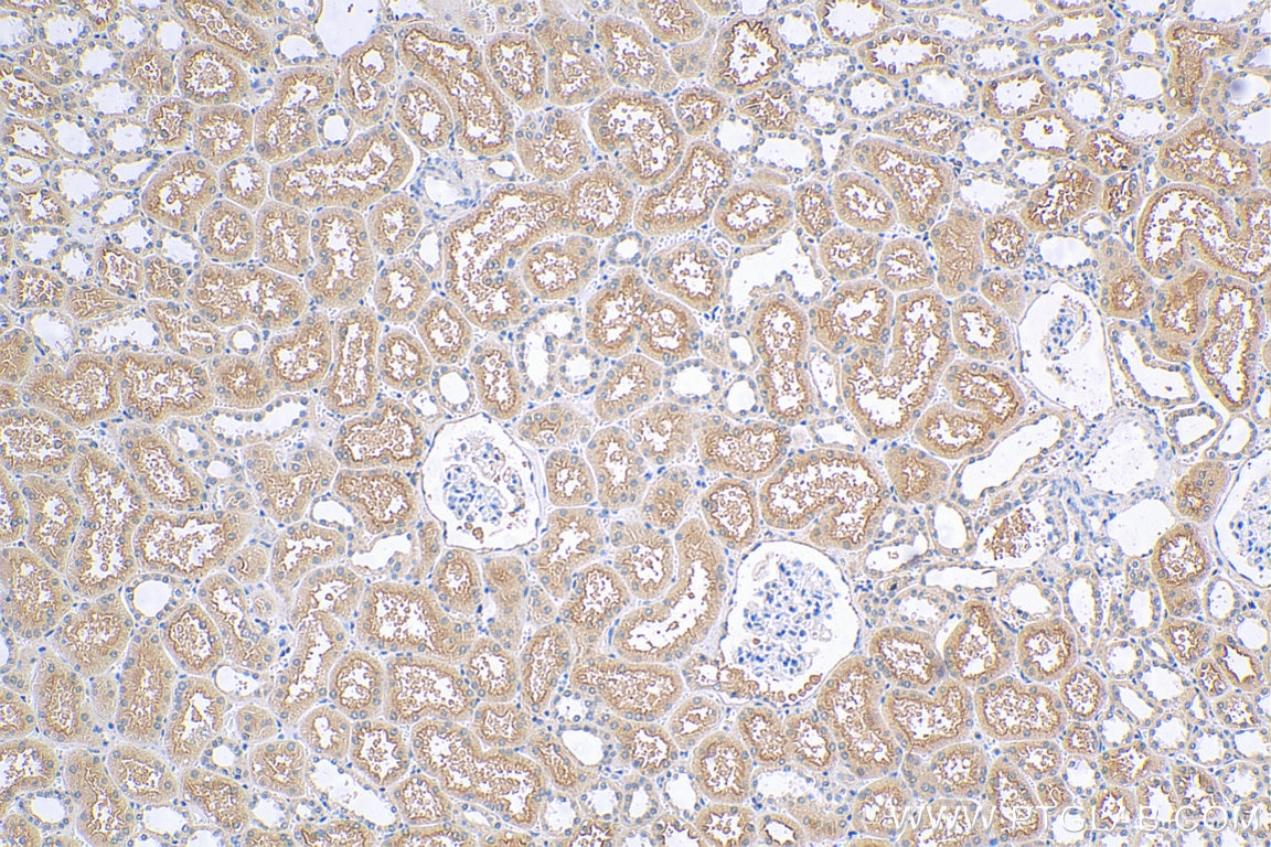 Immunohistochemistry (IHC) staining of human kidney tissue using SLC6A19 Polyclonal antibody (29372-1-AP)