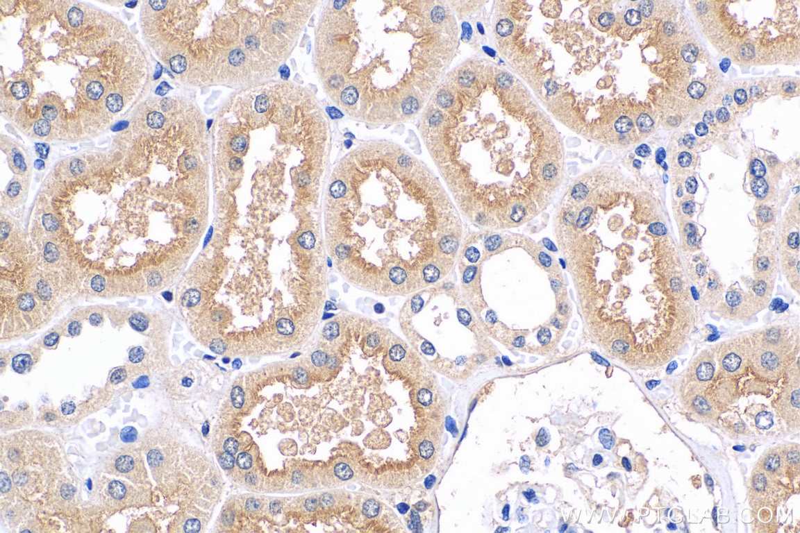 Immunohistochemistry (IHC) staining of human kidney tissue using SLC6A19 Polyclonal antibody (29372-1-AP)