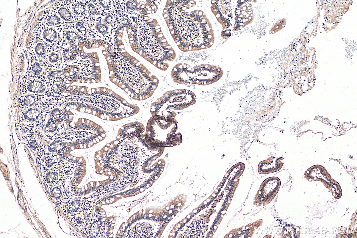 Immunohistochemistry (IHC) staining of human small intestine tissue using SLC6A19 Polyclonal antibody (29372-1-AP)