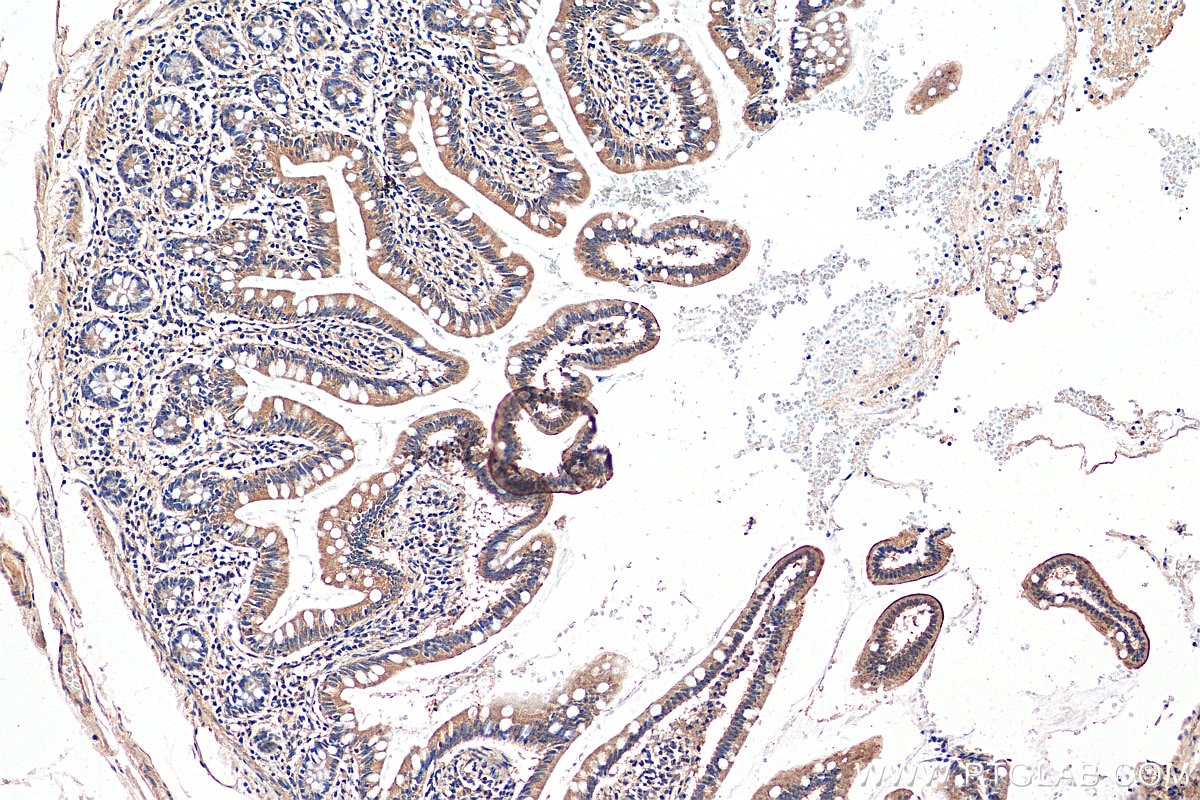 IHC staining of human small intestine using 29372-1-AP