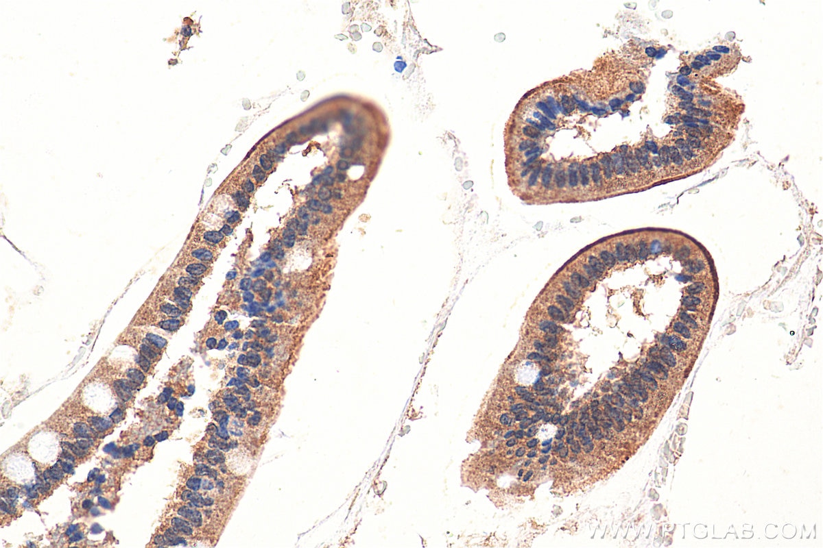 Immunohistochemistry (IHC) staining of human small intestine tissue using SLC6A19 Polyclonal antibody (29372-1-AP)