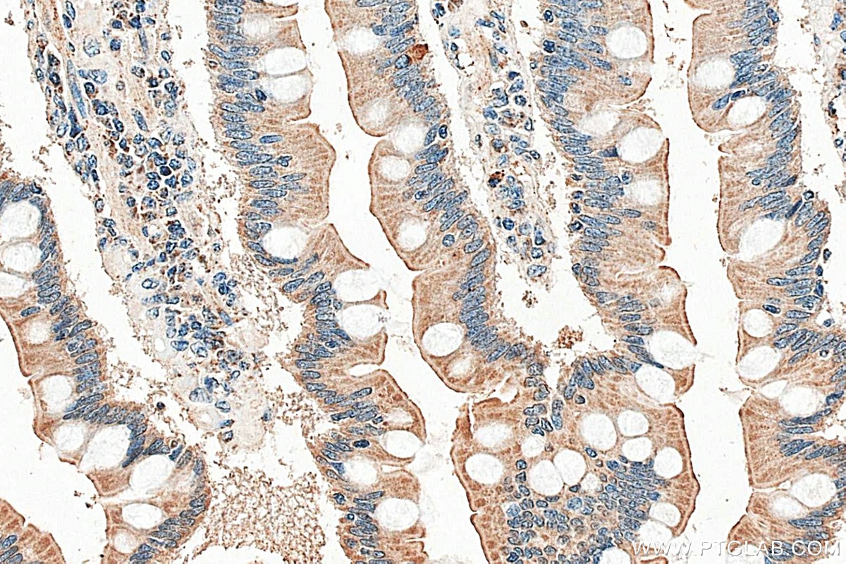 IHC staining of human small intestine using 29372-1-AP Immunohistochemistry (IHC) staining of human small intestine tissue using SLC6A19 Polyclonal antibody (29372-1-AP)