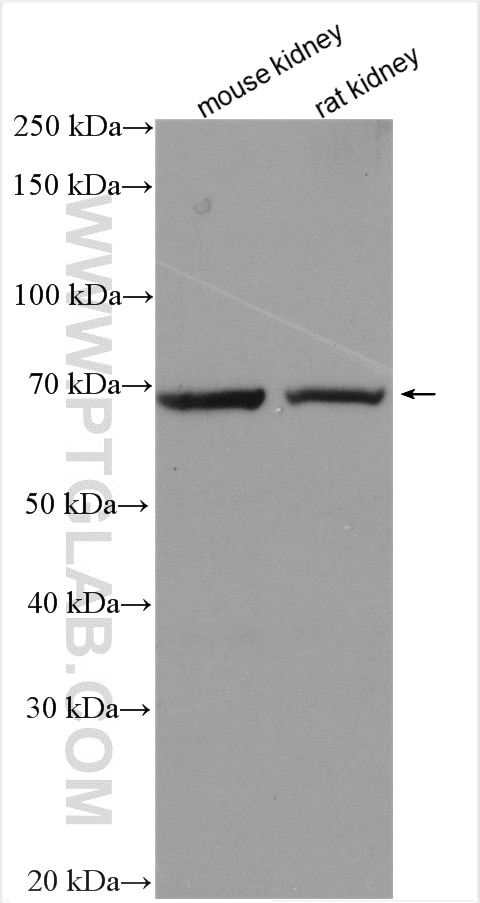 Western Blot (WB) analysis of various lysates using SLC6A19 Polyclonal antibody (29372-1-AP)