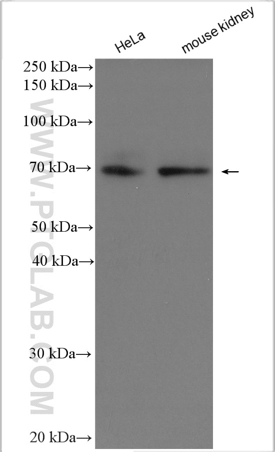 Western Blot (WB) analysis of various lysates using SLC6A19 Polyclonal antibody (29372-1-AP)
