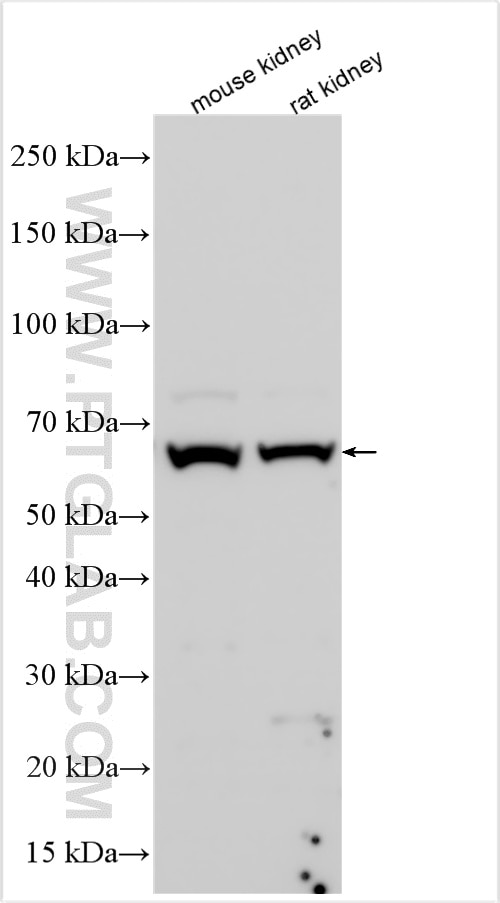 WB analysis using 29372-1-AP Western Blot (WB) analysis of various lysates using SLC6A19 Polyclonal antibody (29372-1-AP)