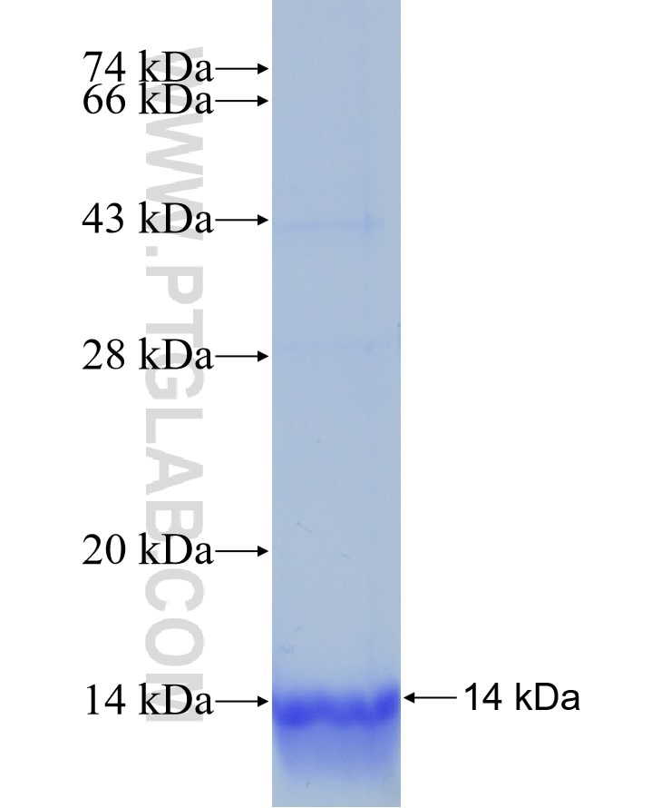 SLC6A19 fusion protein Ag24362 SDS-PAGE