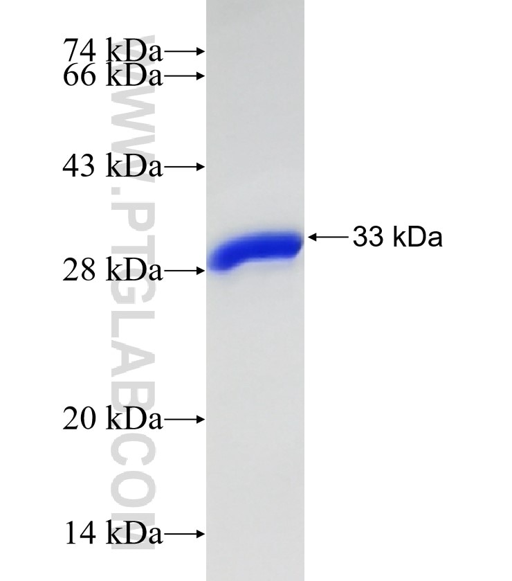 SLC6A19 fusion protein Ag31076 SDS-PAGE