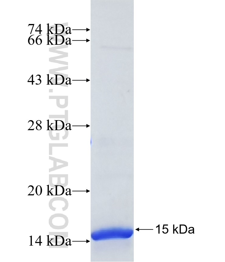 SLC6A2 fusion protein Ag40050 SDS-PAGE SLC6A2 fusion protein Ag40050 SDS-PAGE