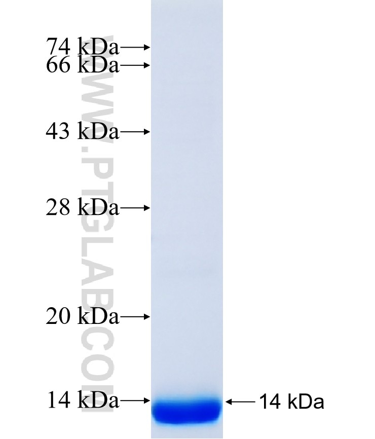 SLC6A2 fusion protein Ag40431 SDS-PAGE SLC6A2 fusion protein Ag40431 SDS-PAGE