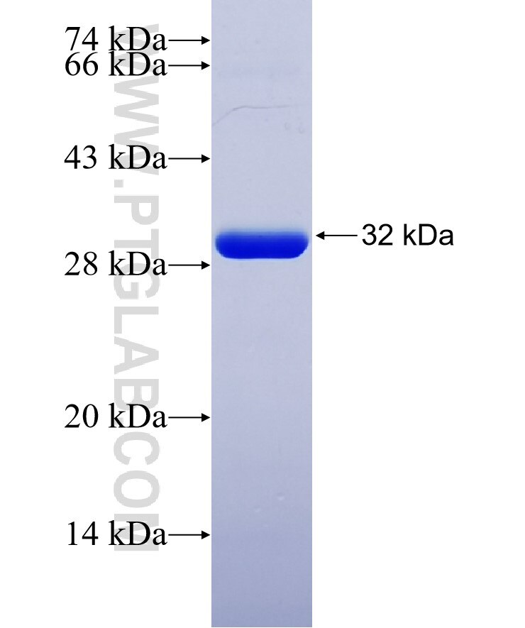 SLC6A2 fusion protein Ag13289 SDS-PAGE