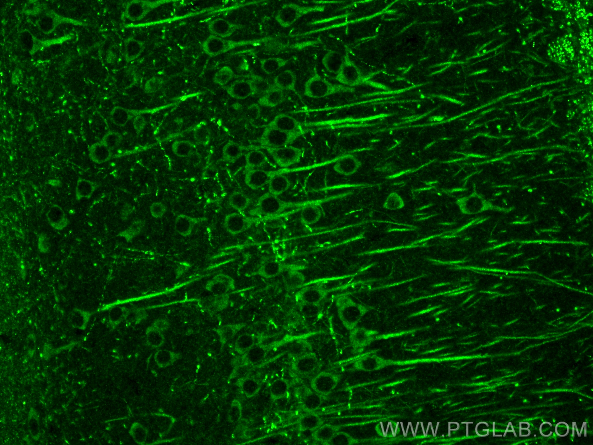 Immunofluorescence (IF) / fluorescent staining of mouse brain tissue using SLC6A20 Polyclonal antibody (30843-1-AP)