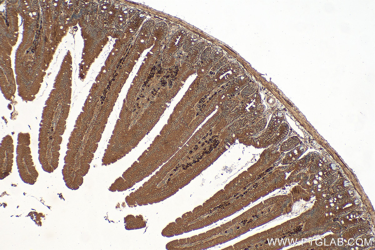 Immunohistochemistry (IHC) staining of mouse small intestine tissue using SLC6A20 Polyclonal antibody (30843-1-AP)