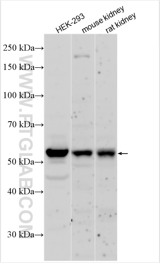 Western Blot (WB) analysis of various lysates using SLC6A20 Polyclonal antibody (30843-1-AP)