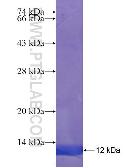 SLC6A20 fusion protein Ag23194 SDS-PAGE
