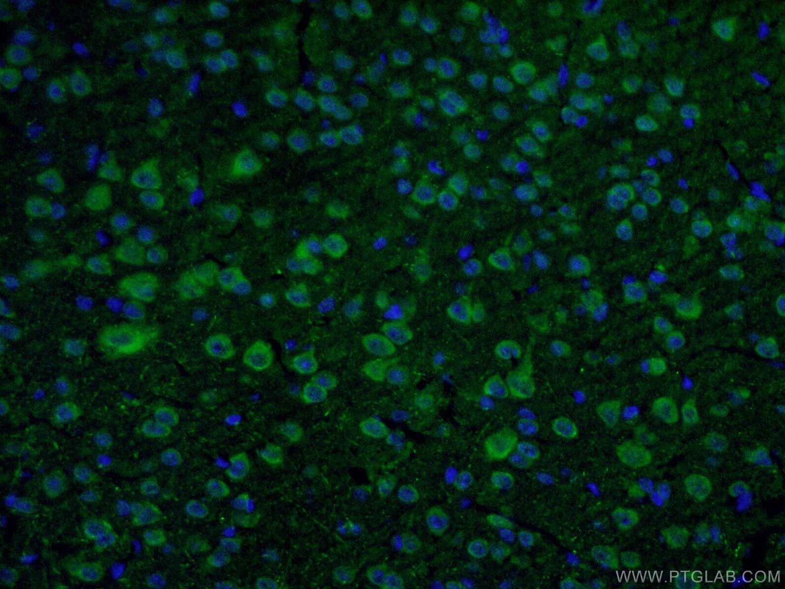 Immunofluorescence (IF) / fluorescent staining of mouse brain tissue using DAT Polyclonal antibody (22524-1-AP)