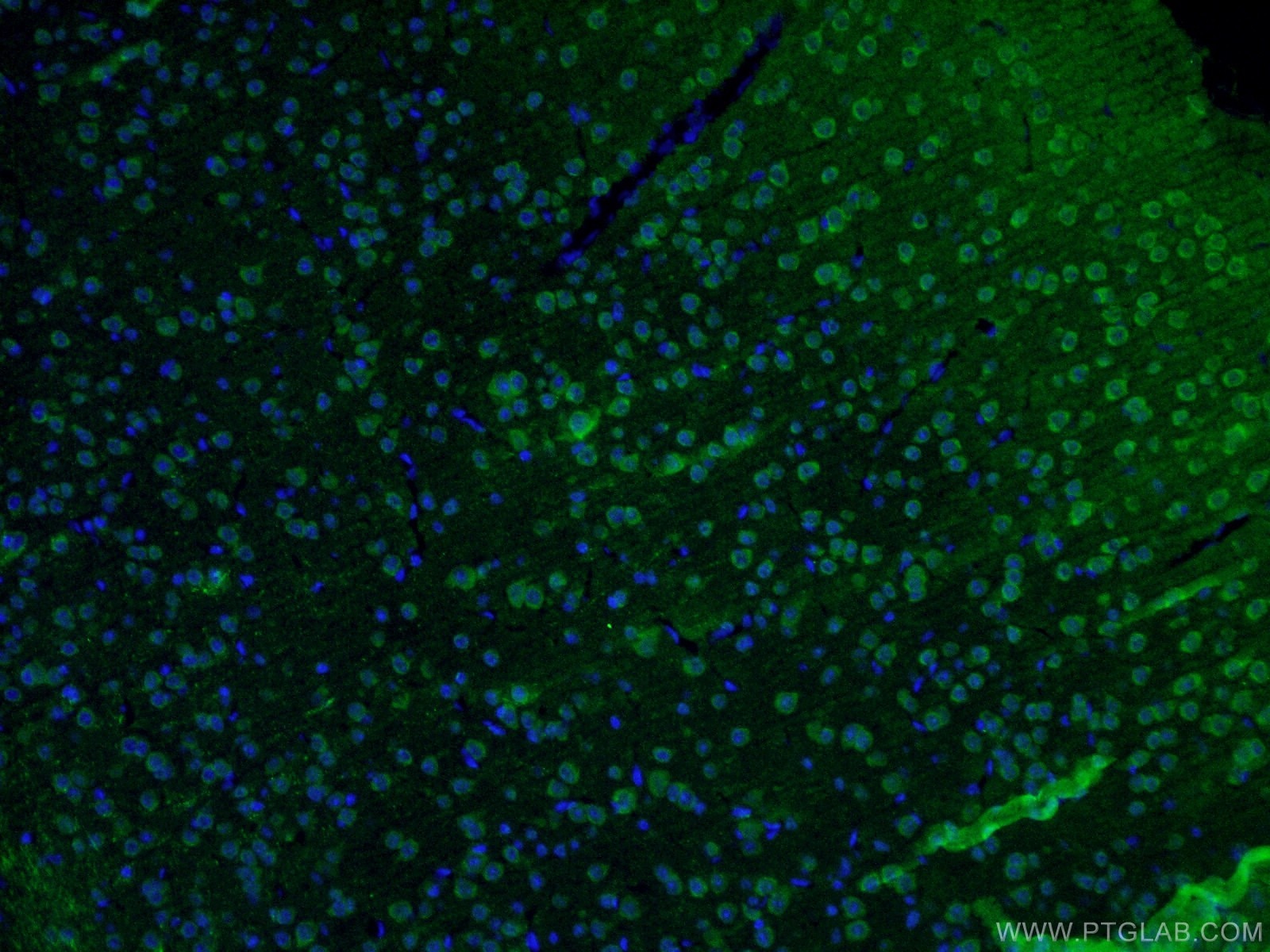 Immunofluorescence (IF) / fluorescent staining of mouse brain tissue using DAT Polyclonal antibody (22524-1-AP)