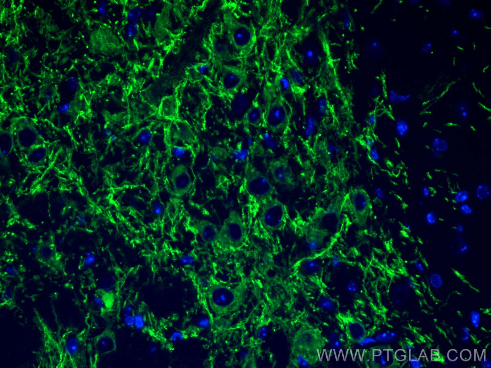 Immunofluorescence (IF) / fluorescent staining of mouse brain tissue using DAT Polyclonal antibody (22524-1-AP)