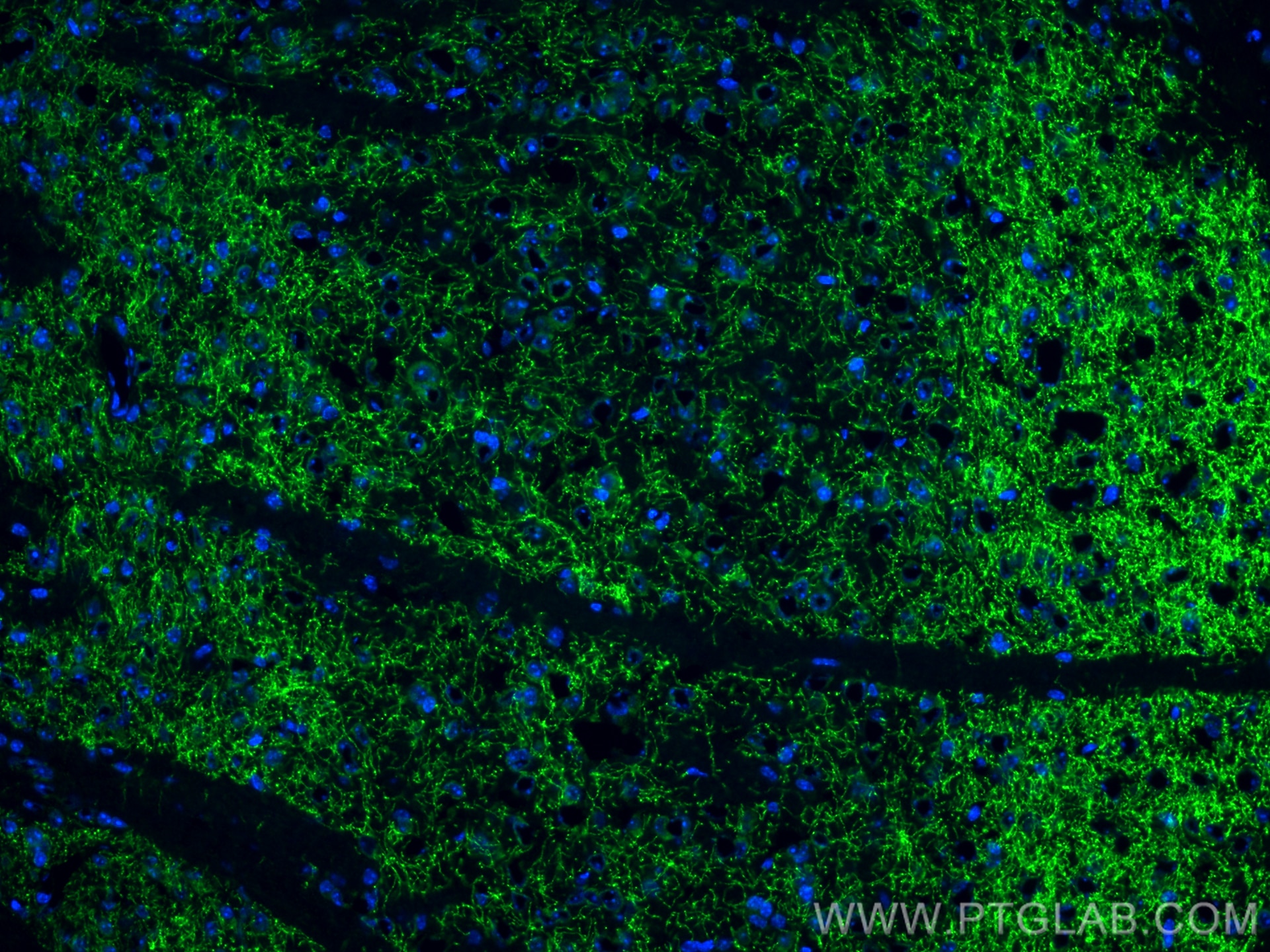 Immunofluorescence (IF) / fluorescent staining of mouse brain tissue using Dopamine Transporter/DAT Polyclonal antibody (22524-1-AP)