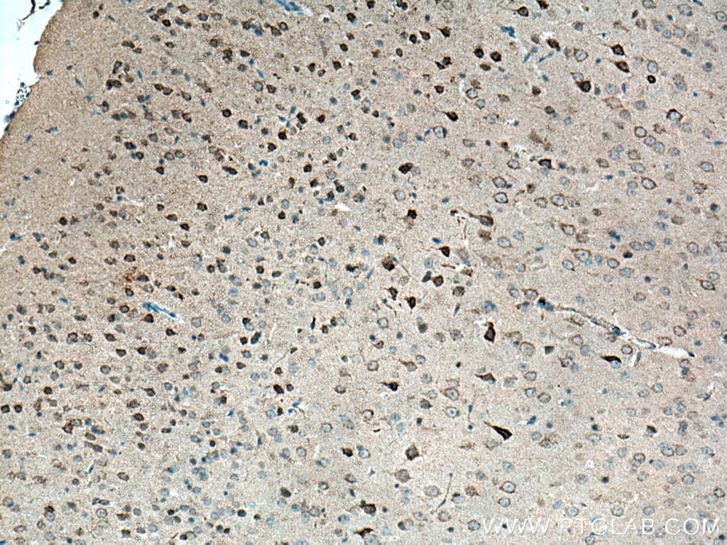 Immunohistochemistry (IHC) staining of mouse brain tissue using DAT Polyclonal antibody (22524-1-AP)