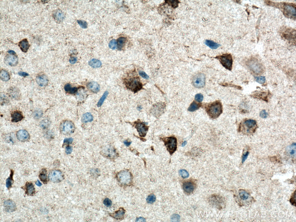 Immunohistochemistry (IHC) staining of mouse brain tissue using DAT Polyclonal antibody (22524-1-AP)