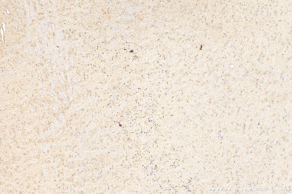 Immunohistochemistry (IHC) staining of mouse brain tissue using Dopamine Transporter/DAT Polyclonal antibody (22524-1-AP)