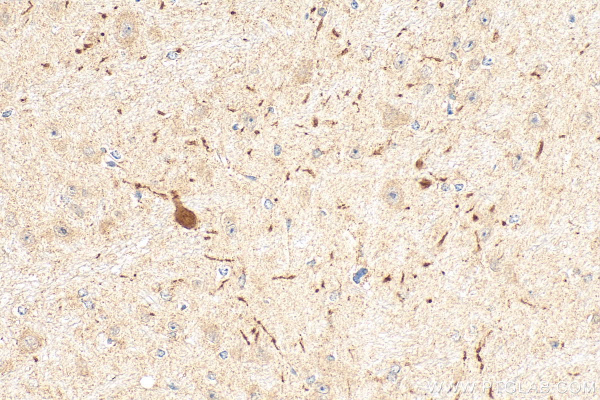 Immunohistochemistry (IHC) staining of mouse brain tissue using Dopamine Transporter/DAT Polyclonal antibody (22524-1-AP)